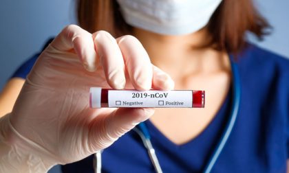 Coronavirus: i nuovi positivi del 4 luglio nel Lecchese e nella Bergamasca