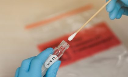 Coronavirus, in Lombardia individuato un test sierologico affidabile