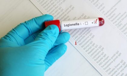 Legionella all’asilo e in biblioteca