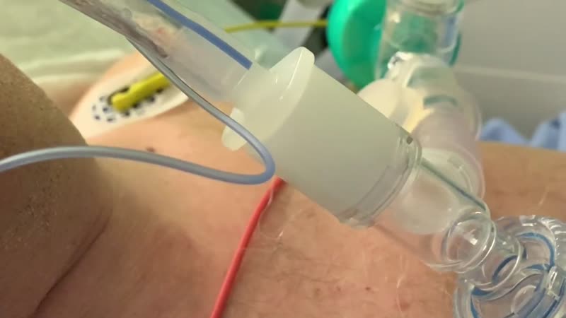 Un VIDEO in cui a parlare sono i suoni del reparto Covid dell’ospedale