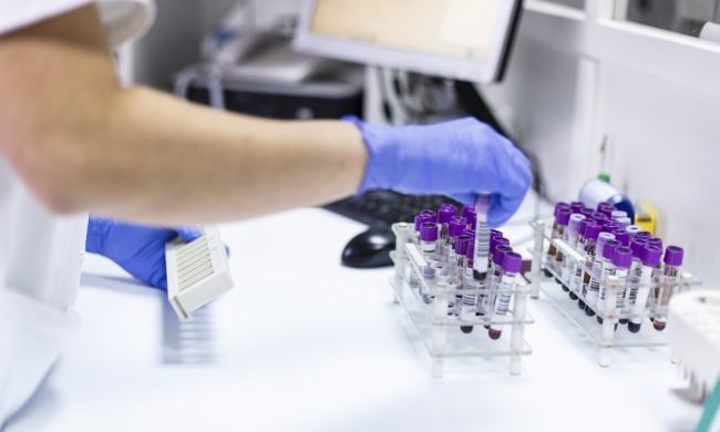 Caso di legionella in Brianza, arriva la comunicazione di Ats