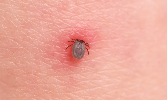 Punture di zecche: i consigli di Ats Brianza per proteggersi