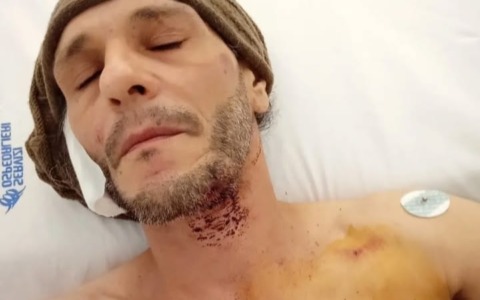 Assalito da una mucca, ne porta ancora i segni: il racconto