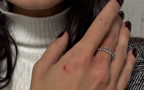 Rimpatriato con scorta internazionale il gambiano che aggredì la modella sul treno