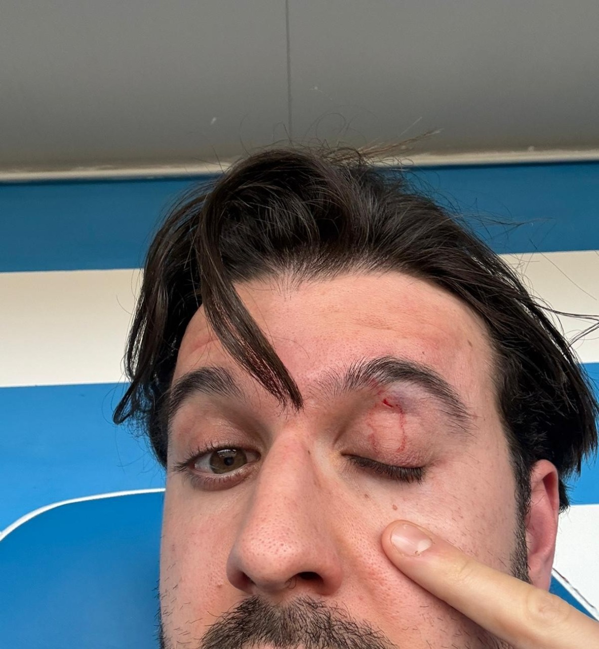 Follia sugli spalti, il direttore tecnico preso a pugni dal papà di un calciatore