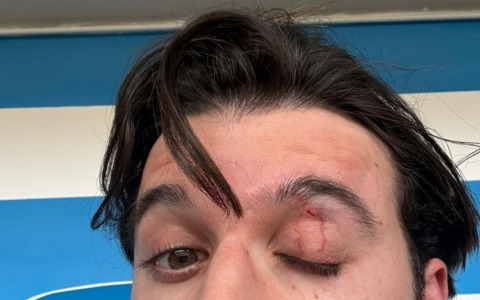 Follia sugli spalti, il direttore tecnico preso a pugni dal papà di un calciatore